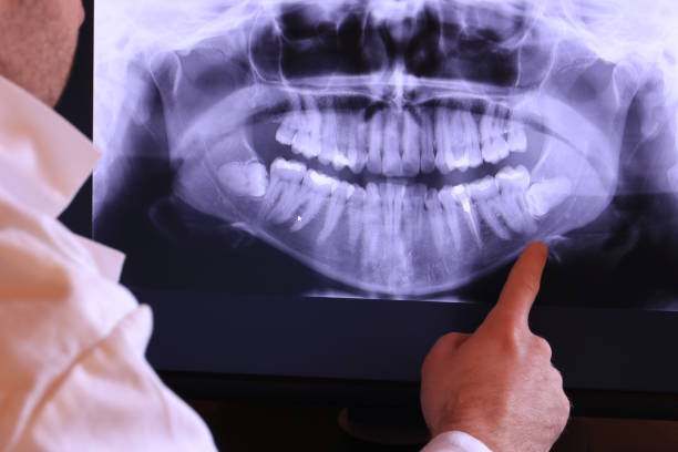 Best Emergency Dental Care for Abscessed Tooth in Orchard Grass Hills, KY